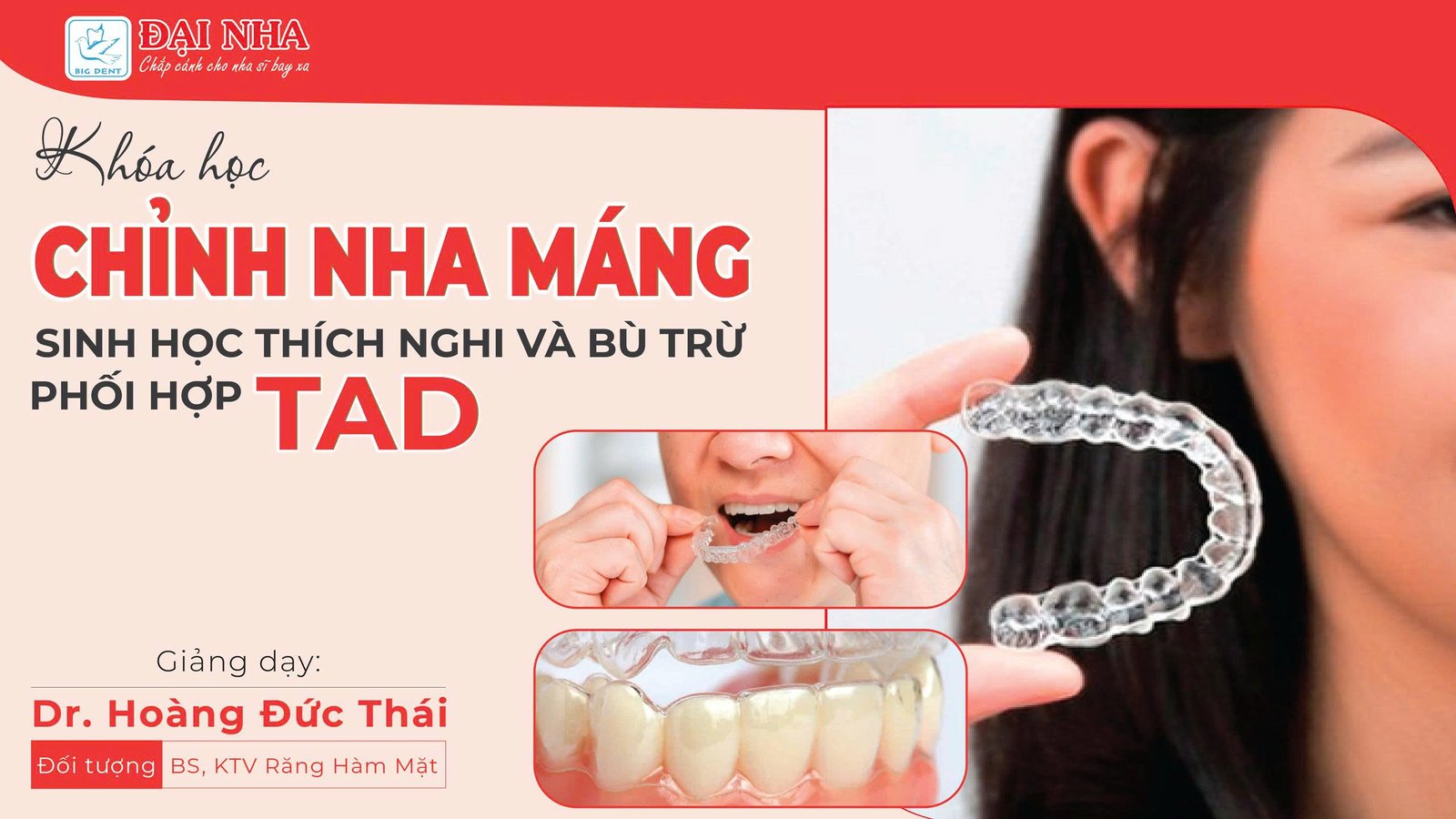 Khóa Chỉnh Nha Máng Sinh Học Thích Nghi Và Bù Trừ Phối Hợp TAD – Đợt 1